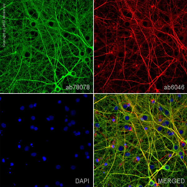 &beta;-III Tubulin&mdash;&mdash;神经科学研究的明星标记物